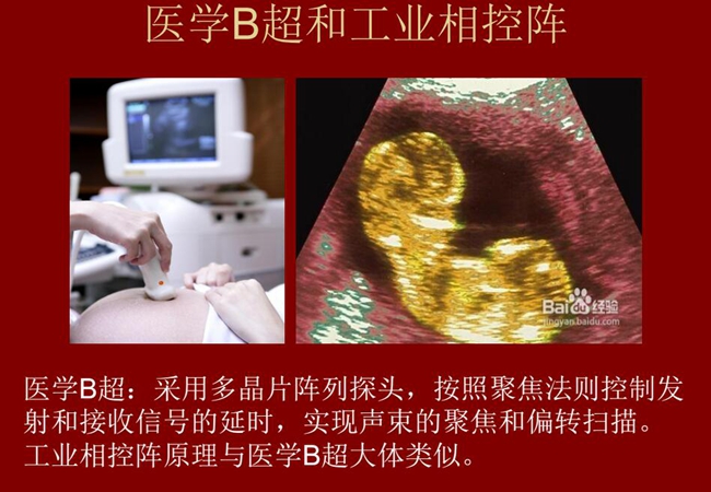 工業(yè)相控陣原理與醫(yī)學(xué)B超大體類似，醫(yī)學(xué)B超采用多晶片陣列探頭，按照聚焦法則控制發(fā)射和接收信號(hào)的延時(shí)，實(shí)現(xiàn)聲束的聚焦和偏轉(zhuǎn)掃描